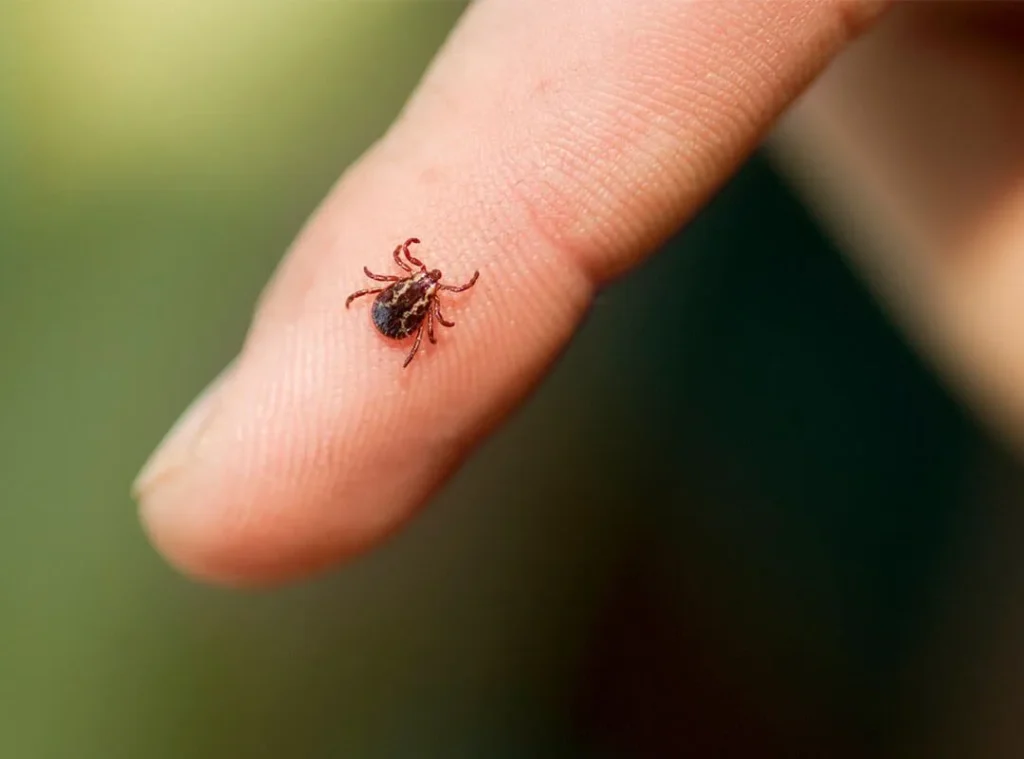 Tick removal Avon